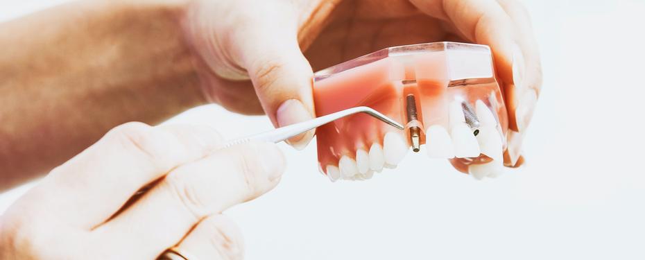 what-is-prosthodontist@2x